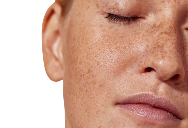 cropped-shot-of-the-face-of-a-young-woman-with-fre-2025-03-05-05-36-20-utc-removebg-preview